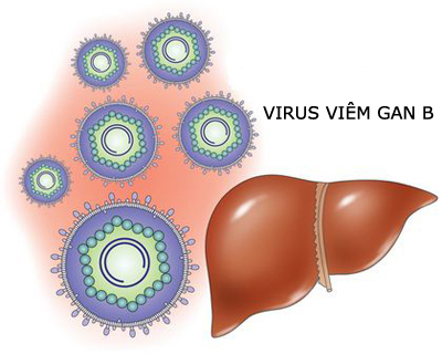 Ngày càng nhiều người mắc bệnh viêm gan B
