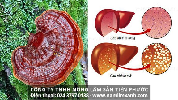 Nấm lim xanh chữa bệnh gan nhiễm mỡ và cách nấu nấm lim xanh rừng